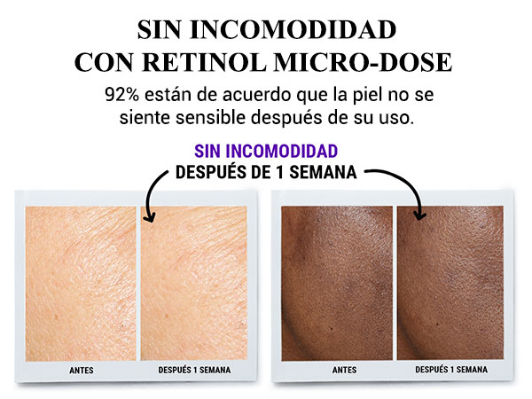 anticaida