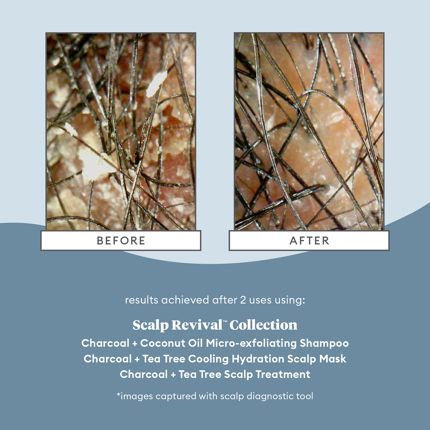 SCALP REVIVAL CHARCOAL + TEA TREE COOLING HYDRATION MASK FOR DRY, ITCHY SCALP (MASCARILLA CAPILAR HIDRATANTE)